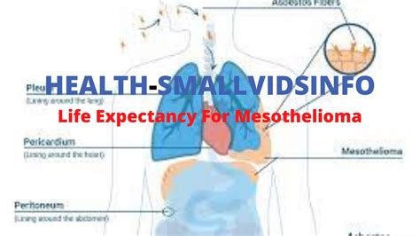 5 Simple Tips For Life Expectancy For Mesothelioma In 2022 Youtube