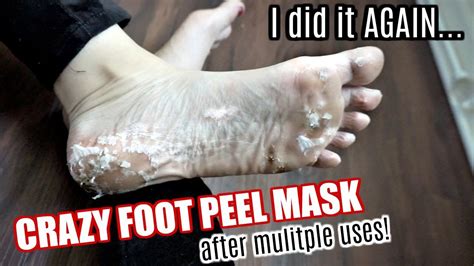I Used A Crazy Foot Peel Mask Again What Happens After Multiple Uses
