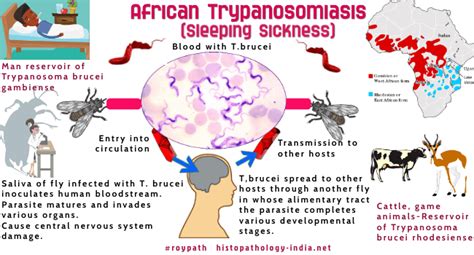 Talentiert So Wie Das West African Trypanosomiasis Kompression Vermuten Stau