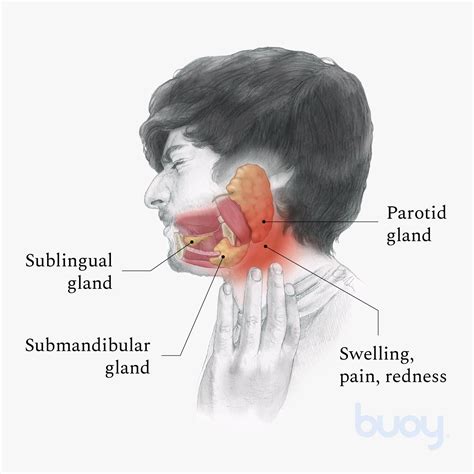 Blocked Salivary Glands In Lips