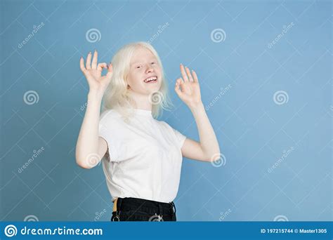 Portrait Of Beautiful Caucasian Albino Girl Isolated On Blue Studio Background Stock Photo