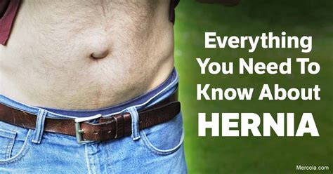 Everything You Need To Know About Hernia