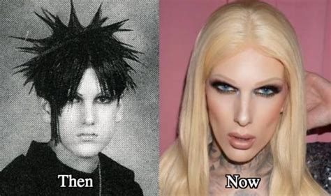 Jeffree Star Plastic Surgery Before And After Photos Latest Plastic