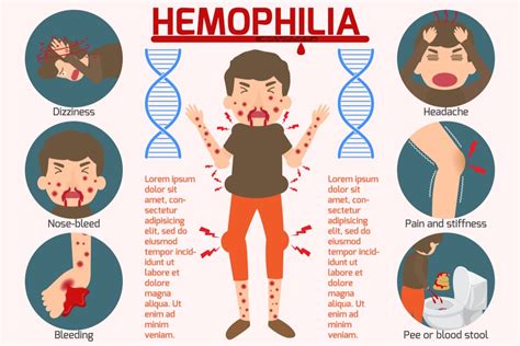 Hemophilia Causes Symptoms Treatment Solution Parmacy