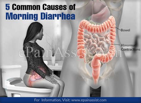 Helps acid reflux or gerd 5 Common Causes of Morning Diarrhea & Its Treatment, Prevention