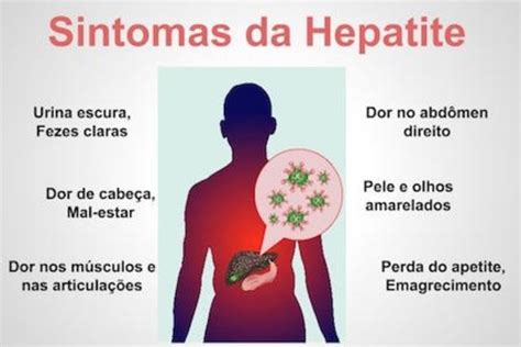 Entenda Os Sintomas Causas E Tratamento Da Hepatite Tua Sa De