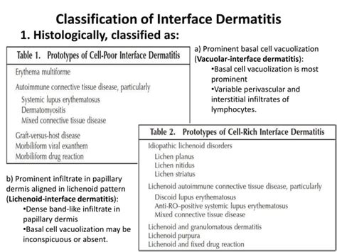 Interface Dermatitis Tutorial
