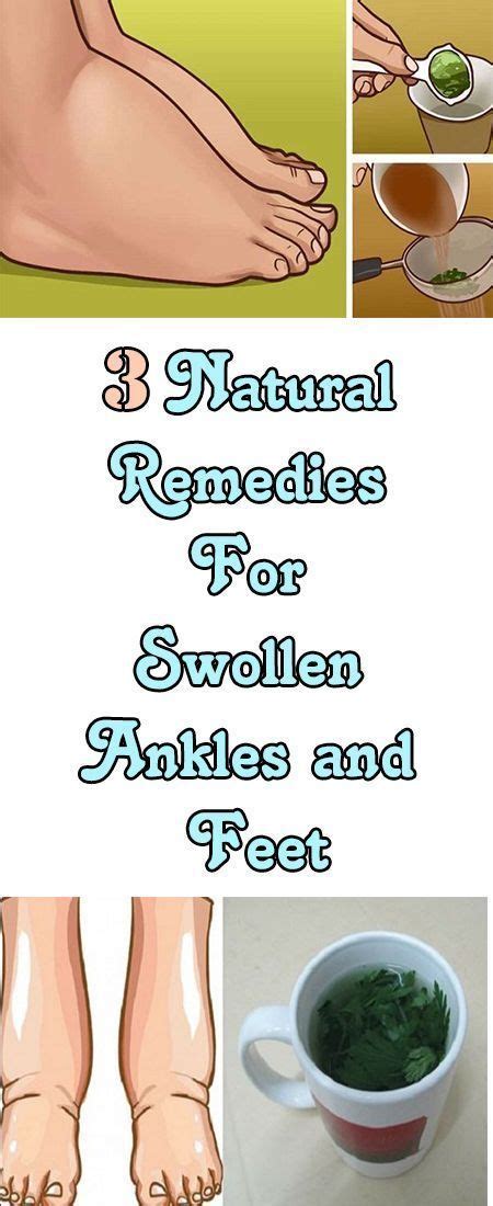 3 Natural Remedies For Swollen Ankles And Feet Health Foot Remedies