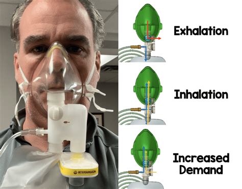 Overall guide to choosing hfnc vs. COVID-19: Airway Management - REBEL EM - Emergency ...