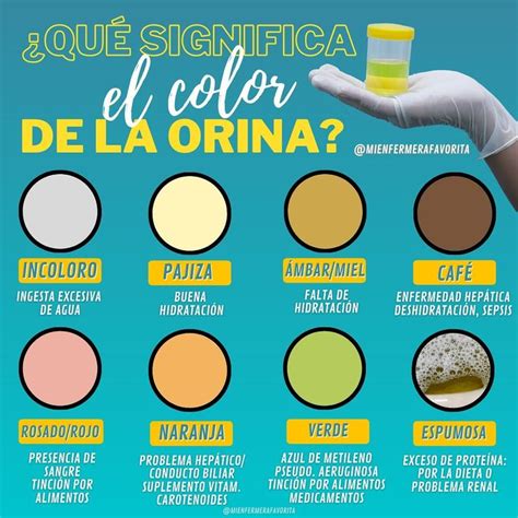 Sint Tico Foto Colores De La Orina Y Su Significado Lleno