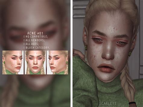 The Sims Resource Acne 01