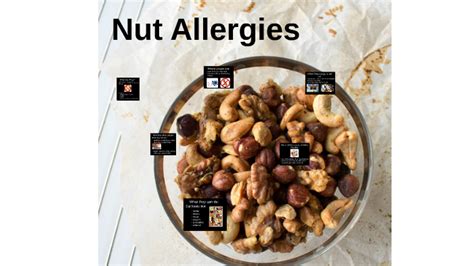 Nut Allergies By Anna D