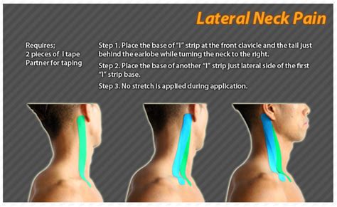 Kinesiology Taping Instructions For Lateral Neck Pain Ktape Ares