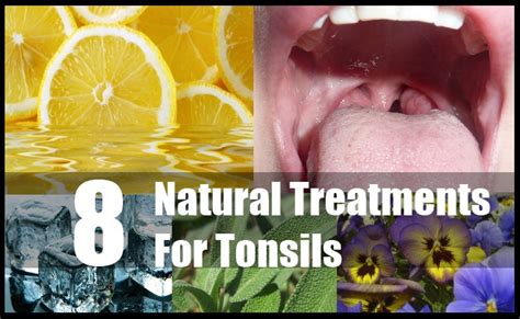 8 Tonsils Natural Treatments And Cures Search Herbal And Home Remedy