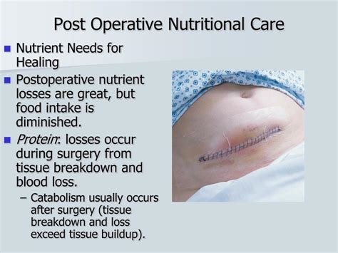 Ppt Surgery And Nutritional Support Powerpoint Presentation Free