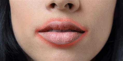 What Causes A Rash Under Your Lips Lipstutorial Org