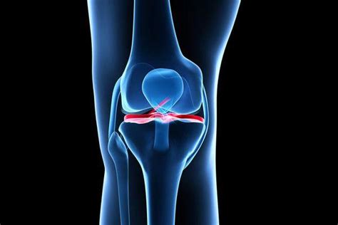 Acl Reconstruction And Injury Treatment