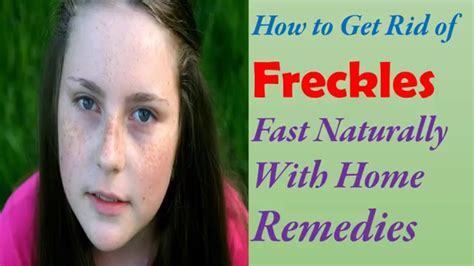 How To Get Rid Of Freckles On Face Fast Naturally Permanently At Home