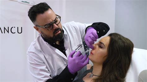 Dr Iancu Morad Procedura De Modelare A Nasului Cu Acid Hialuronic