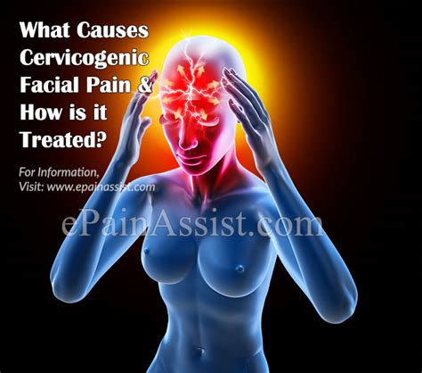 What Causes Cervicogenic Facial Pain And How Is It Treated