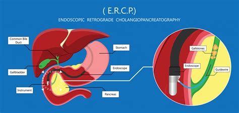 Ercp Anatomy
