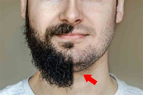 I hope you guys learned something. 5 Smart Ways To Hide A Double Chin For Men - MENSOPEDIA