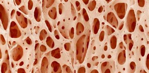 Chapter 6 Bone Tissue Quiz Trivia And Questions