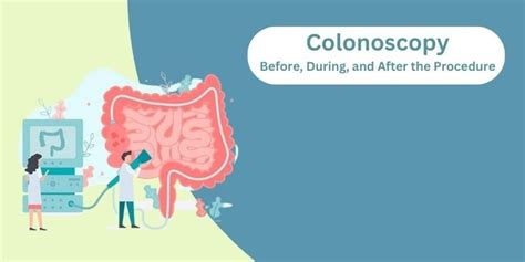 Colonoscopy What Happens Before During And After The Procedure Dr