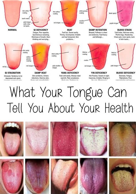 What Your Tongue Says About Your Health Health And Tips