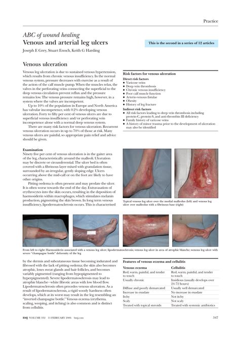 Wound Care Guideline Part Leg Ulceration Dressing Wound Care My XXX