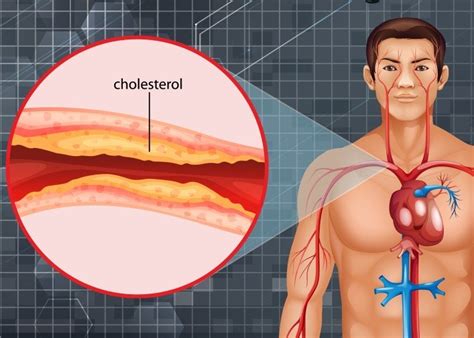 Bagaimana Cara Kerja Kolesterol Dalam Tubuh Ini Penjelasannya