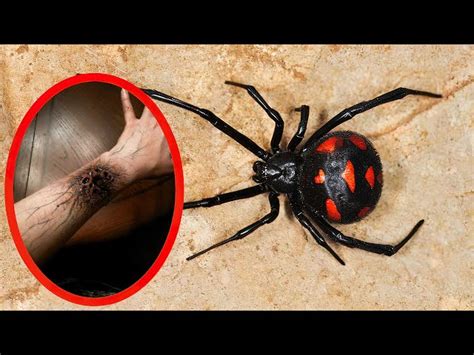Most Dangerous Spider In The World Bites