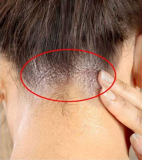 Hair Fungus Causes And How To Stop Them Glowpink Hair Control Smelly Hair Aloe For Hair