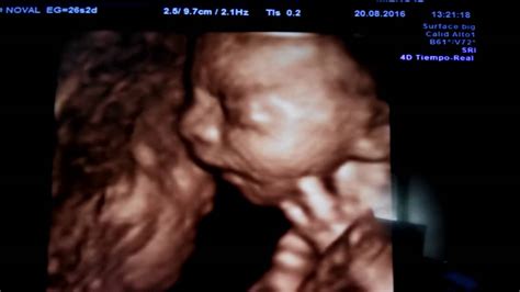 Feto De 26 Semanas Peso Y Talla - Como Esta El Bebe A Las 26 Semanas De Embarazo - Articulo Para Bebes