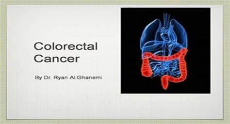Download Free Medical Colorectal Cancer Powerpoint Presentation