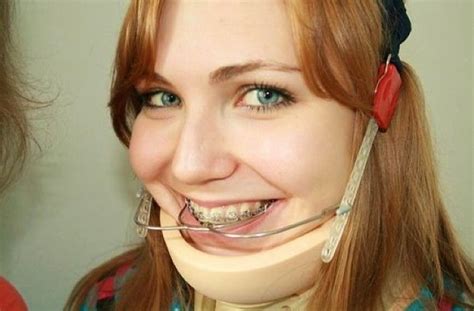 Pin By Megan Ferris On Girls In Headgear Dental Braces Braces Girls Brace Face
