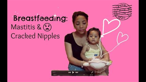 mastitis and cracked nipples does breastfeeding ever get easier youtube