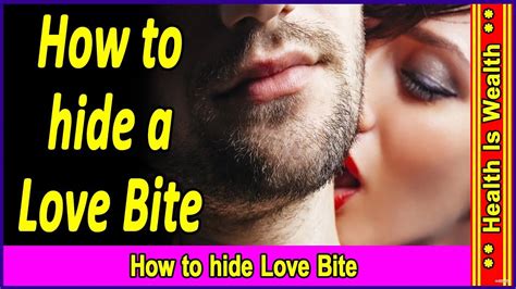 Love Bites के निशान को मिटाने के आसान उपाय How To Get Rid Of Lave Bites How To Hide Love