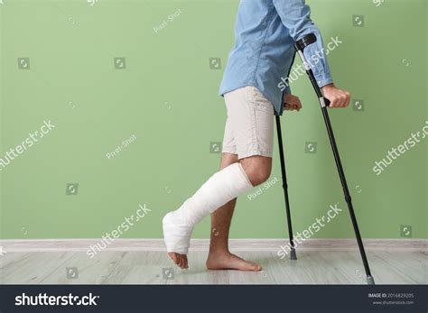 Young Man Broken Leg Near Color Stock Photo 2016829205 Shutterstock