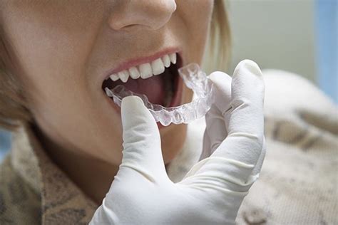 Braces Vs Going To An Invisalign Dentist Gables Exceptional Dentistry