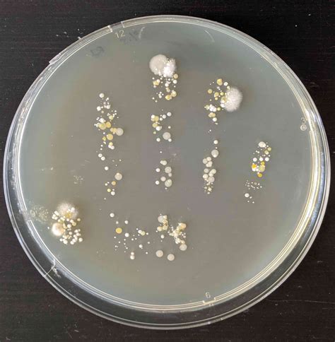 How To See Bacteria On Your Hand Bacteria Handprint Rs Science