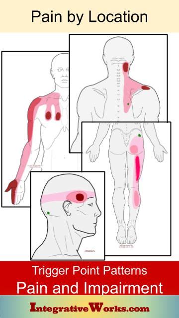 Trigger Point Patterns Of Pain And Impaired Function Integrative Works