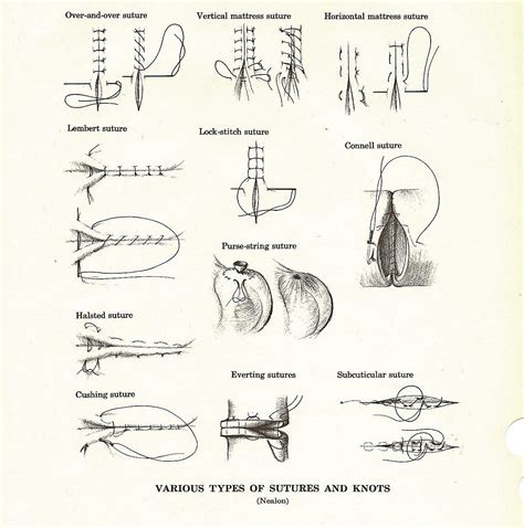 Image Detail For Vintage Medical Anatomy Illustration Of Sutures By