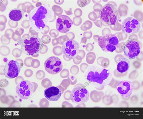 White Blood Cells Under Microscope Micropedia