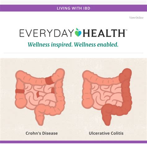 Key Differences Between Crohn S Disease And Ulcerative Colitis Everyday Health