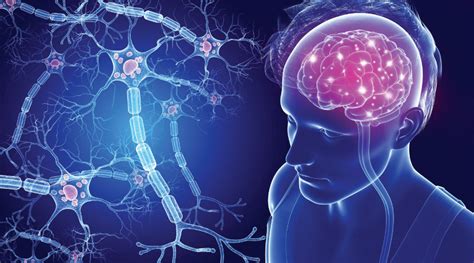 What are usually the early symptoms of Multiple Sclerosis? - MedClique