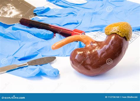 Kidney Operation Scar Stock Photography 13282514