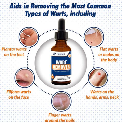 Natural Wart Remover Treatment Liquid Drops Fast Safe For Kids