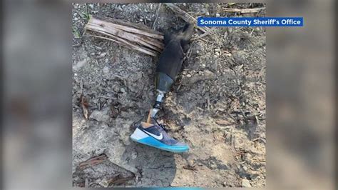 Marin Man Reunited With Prosthetic Leg He Lost While Skydiving In