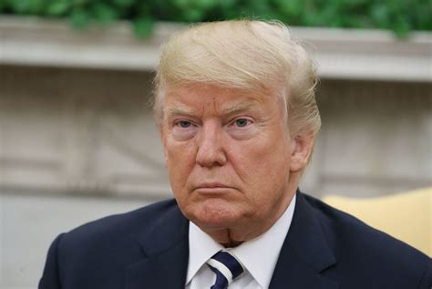 Queens, new york, on june 14, 1946), nicknamed the donald, is the 45th president of the united states of america, as a result of winning the 2016 presidential election as the republican party nominee. Are Donald Trump Hair Transplant Stories Real? - Celebrities hair transplants